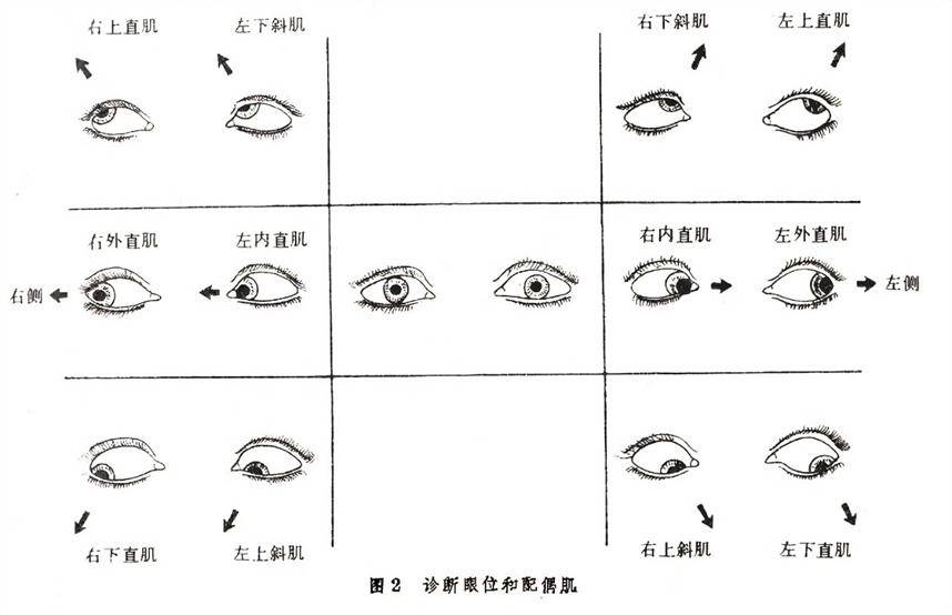 右前斜位置示意图图片