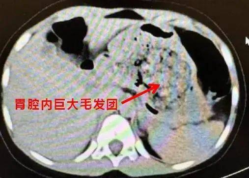 上海高校招生有變姦殺5歲女童惡魔29年後執行死刑200