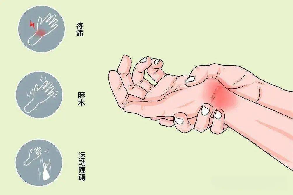 4次手术都没治好"叛逆"囊肿,直到这群好奇医生破了案_大哥_腱鞘