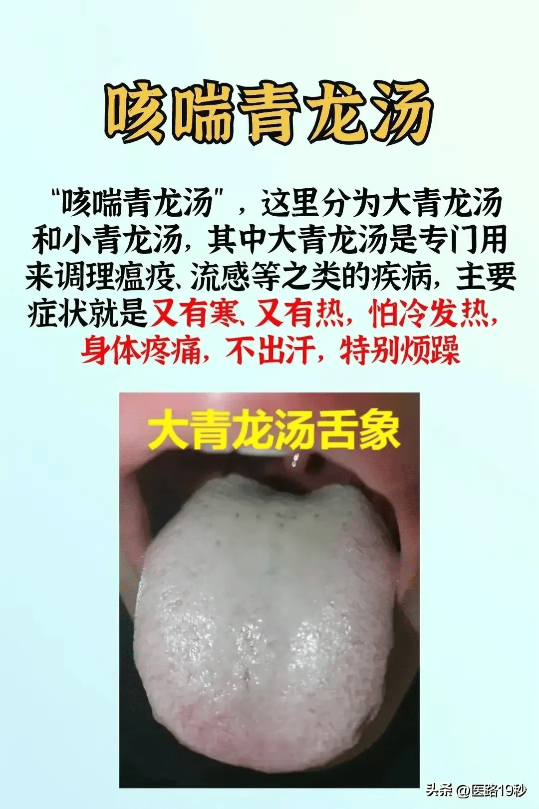 仲景治疗感冒的6大经方建议收藏