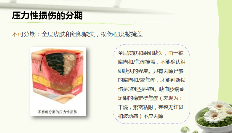 141购买知护优品压力性损伤临床防治国际指南2019 (第3版) 王泠