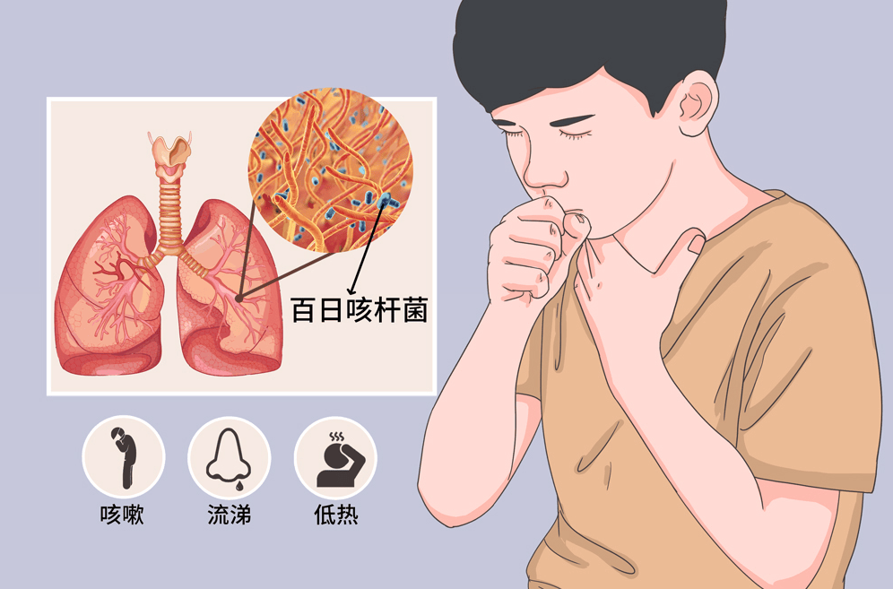 感染猛增具有传染性唐山海港市民注意