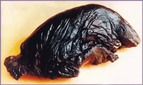 提醒千万不要拿袜子做这件事后果可能非常严重