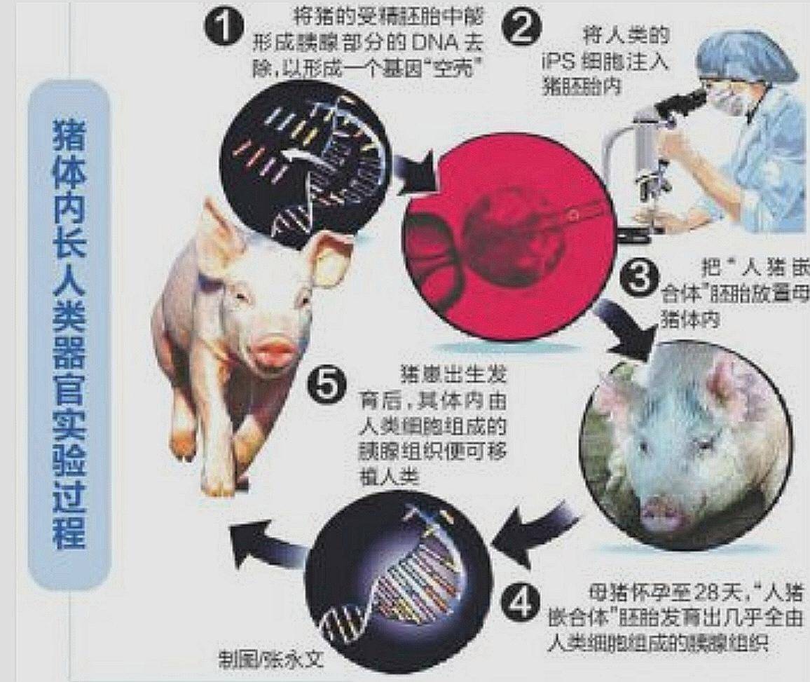 全球首例!美国62岁男子移植猪肾,状态良好,能破异种移植纪录吗