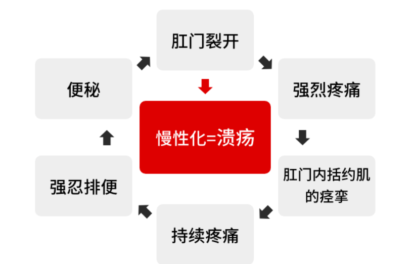 青年医师说排便时疼痛出血并不一定是痔疮惹的祸还有它