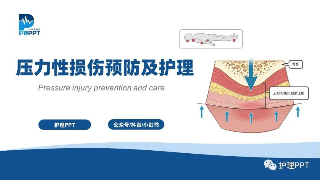 ppt压力性损伤压疮的预防与护理
