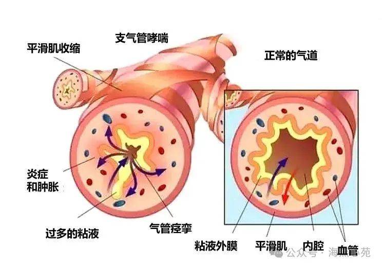 家有哮喘儿父母怎么做