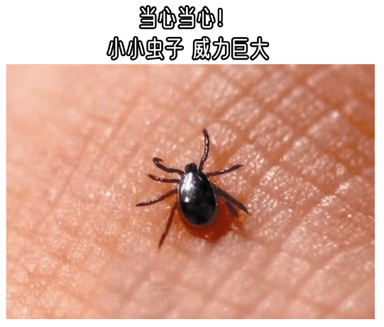 南海女子被虫咬后高烧不退,呼吸衰竭送医…_恙虫_黄女士_医生