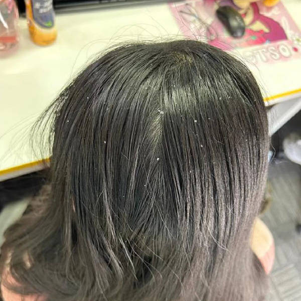 好用止痒洗发水介绍_头皮_头发_问题