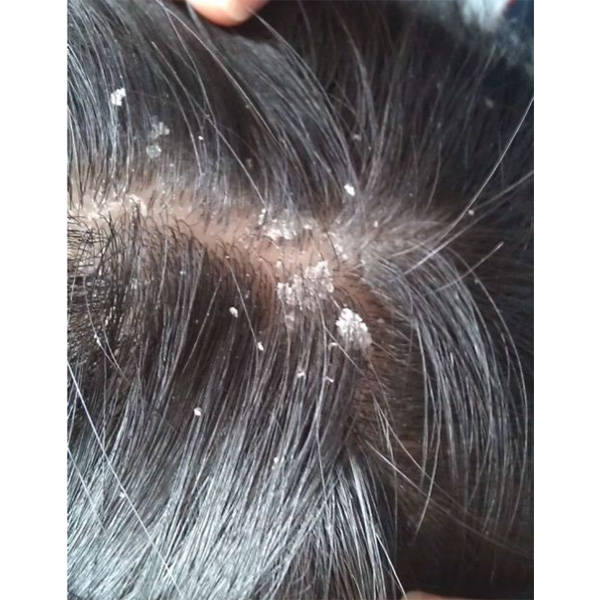 洗发水去屑效果好的牌子去屑止痒洗发水十大排名