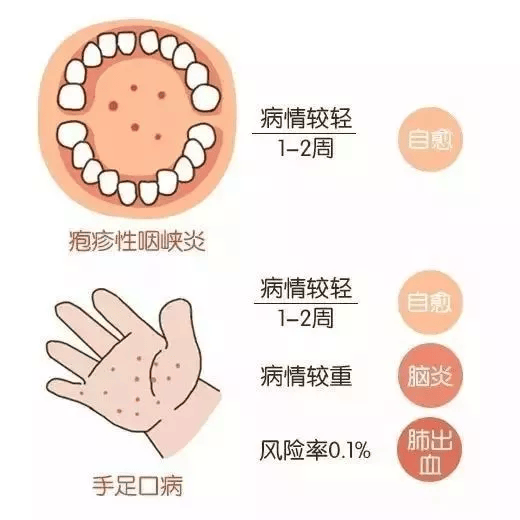 这病高发期到了!