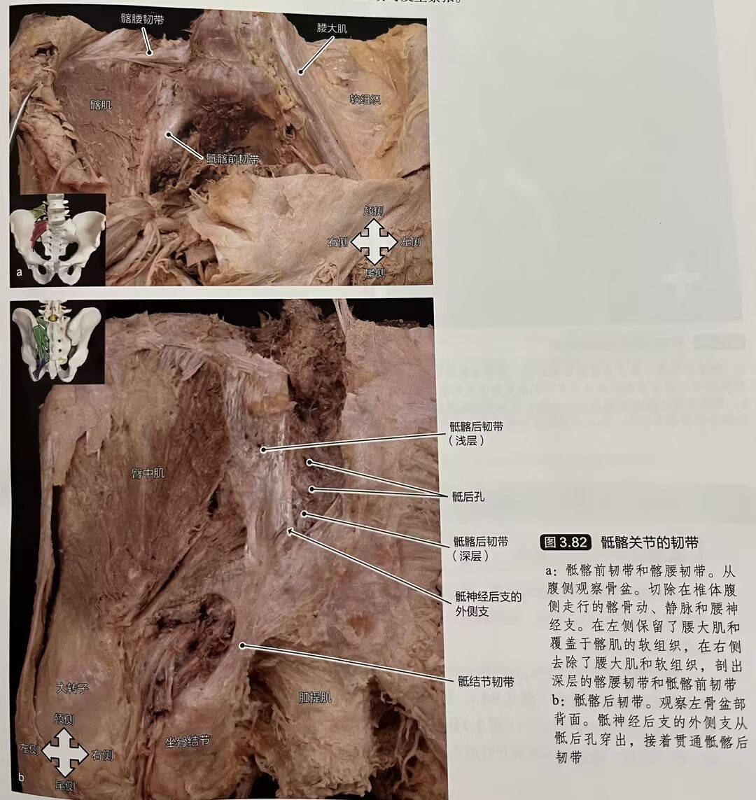 骶髂关节不稳的解剖学分析