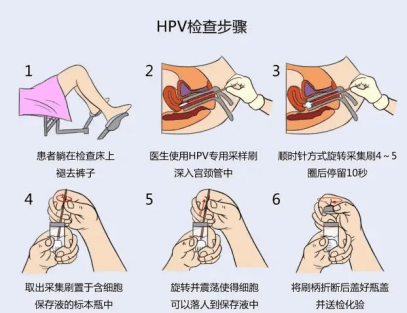 自己检查宫颈的方法图片