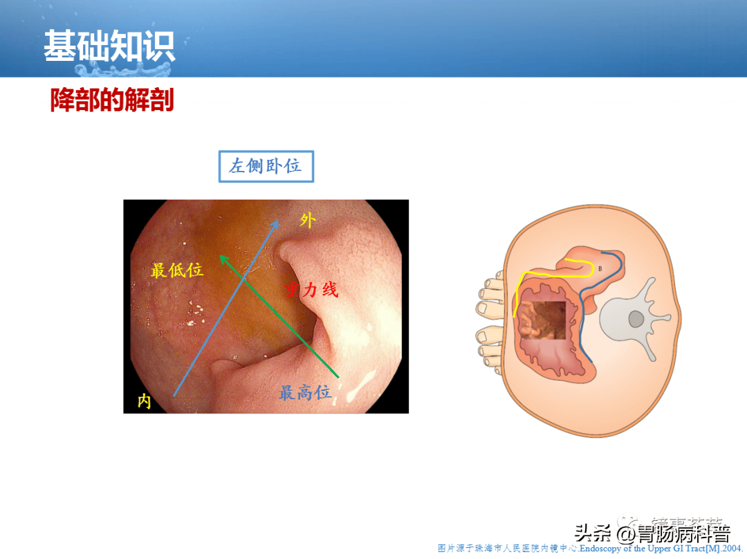电子胃镜操作基础