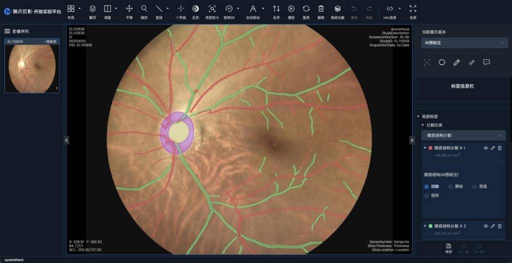 "人工智能 "的前瞻实践:打造医疗影像ai国家级平台