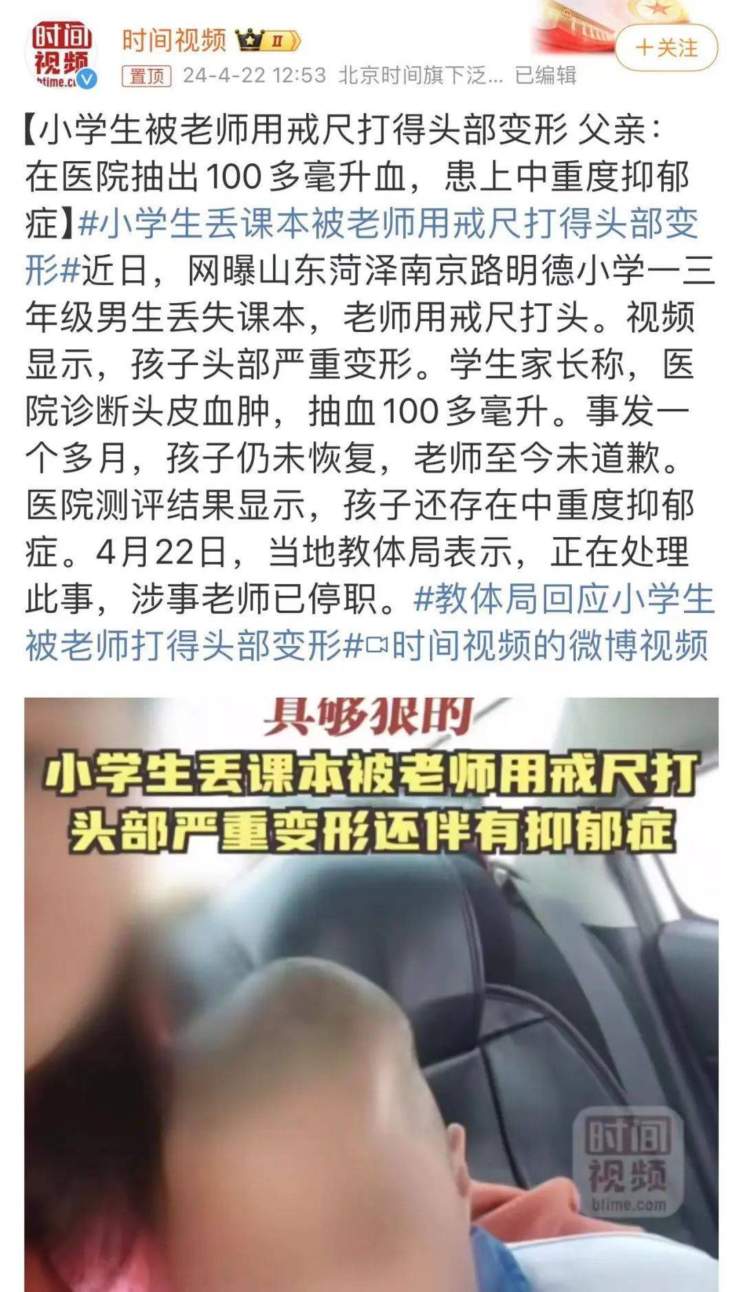 43在迁移雪村战斗烈士墓的过程中,发现了一张夹在小圆镜中的年轻女子