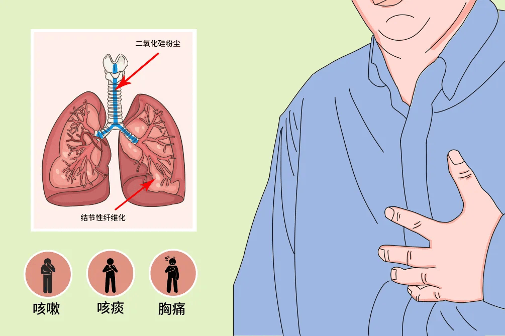 2024年职业病防治法宣传周带你了解尘肺病