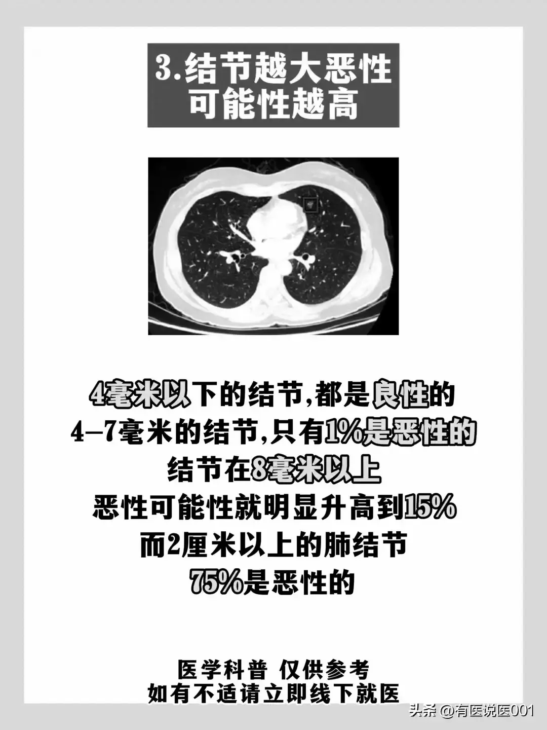 间质性肺炎ct报告单图片