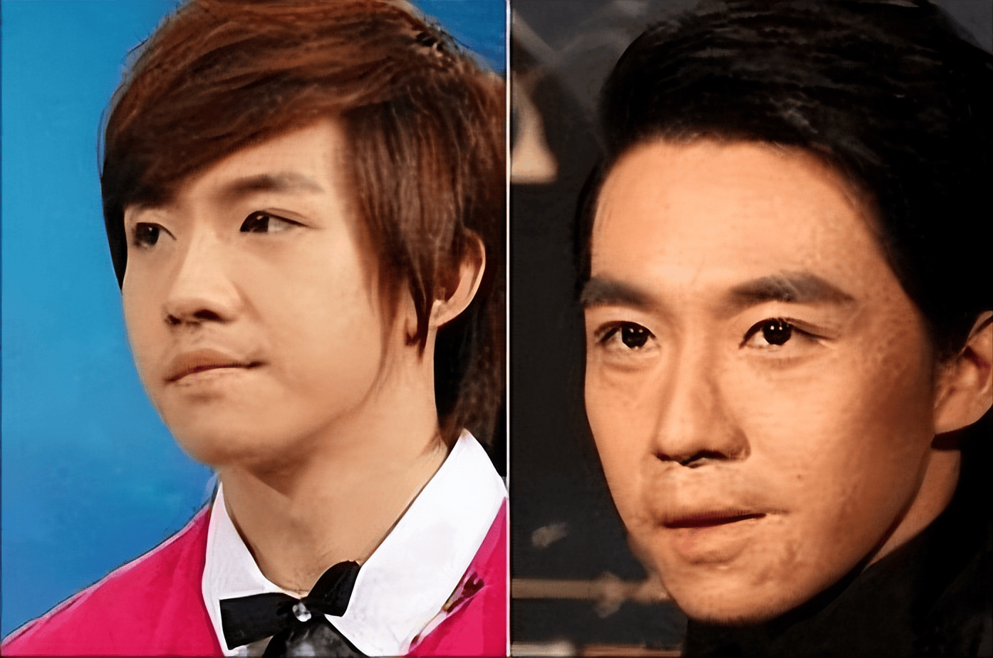 恶毒女配李依晓,被叶璇狗咬毁容,如今面部僵硬遭群嘲!