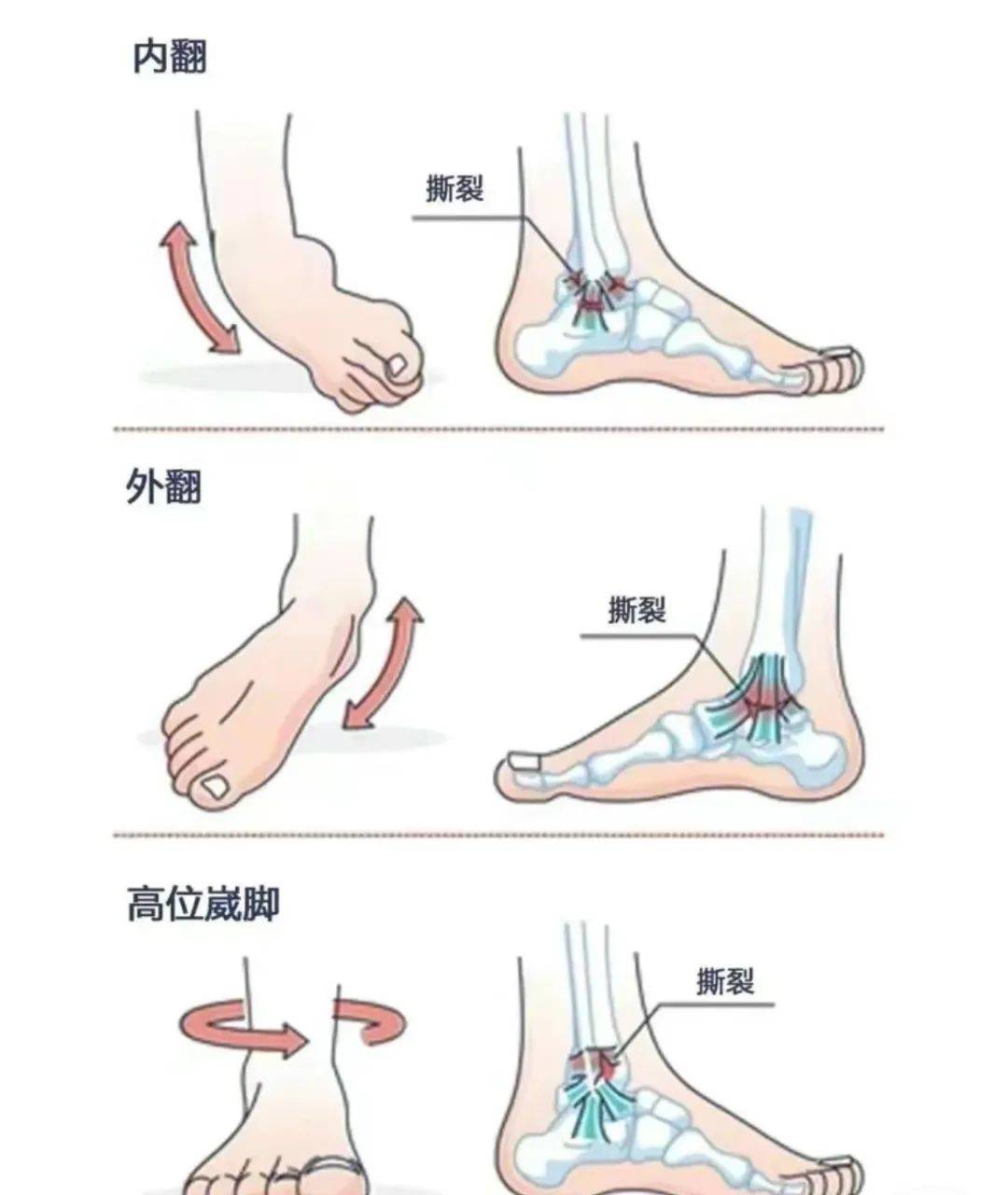 右距骨在什么位置图片图片