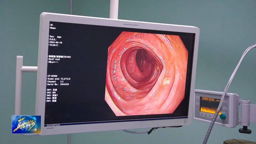 祝您健康|带你了解结直肠癌的近亲——肠息肉
