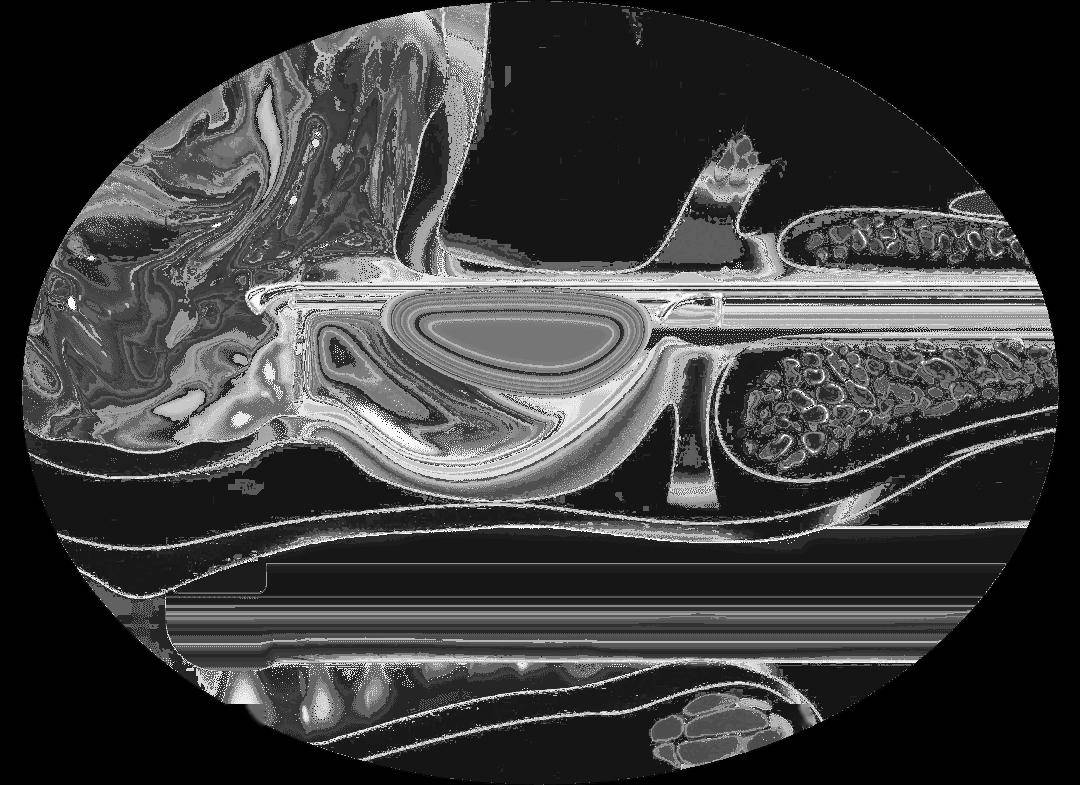 【首发】智愈医疗完成超6000万元pre-a  轮融资,利