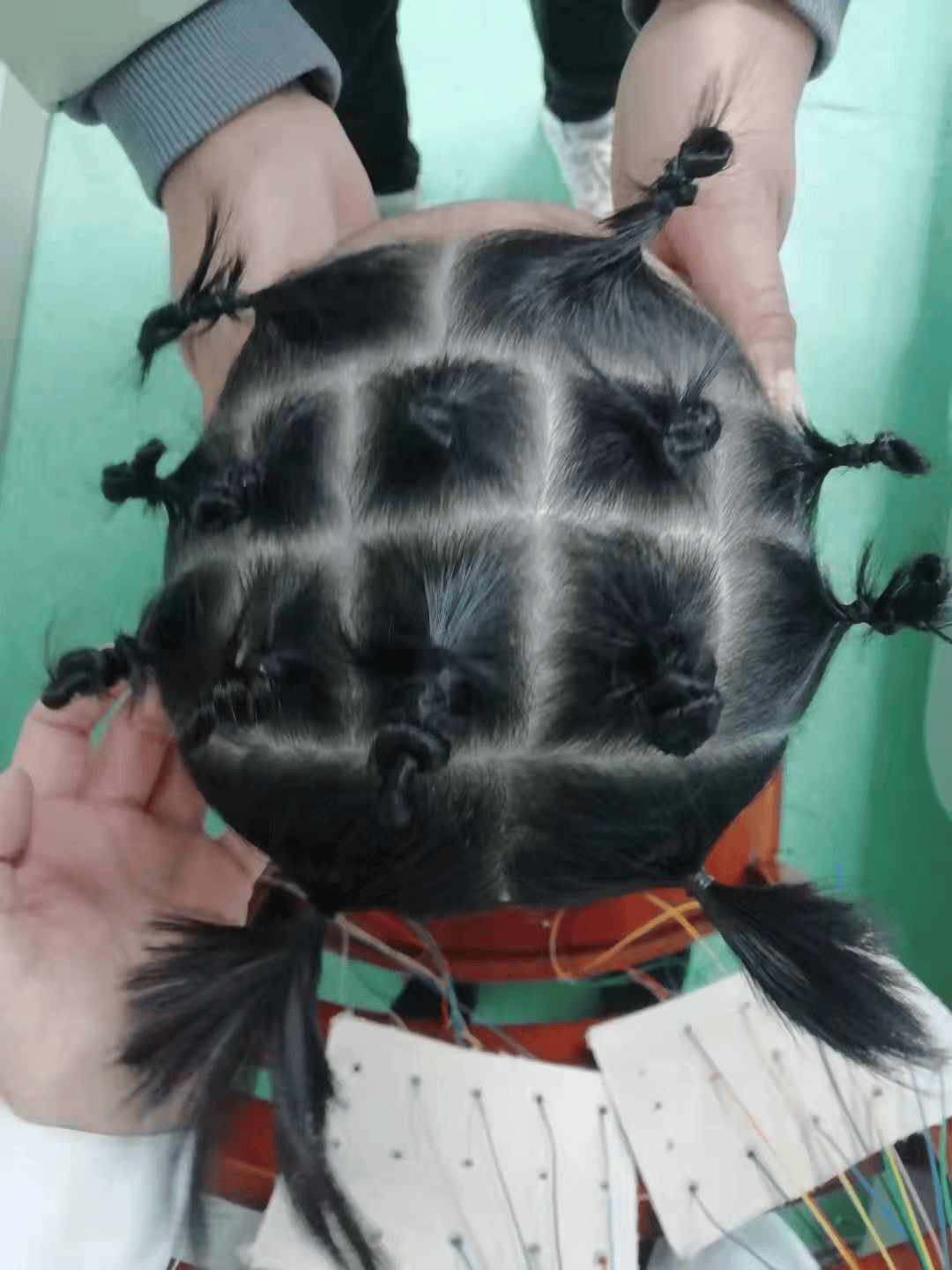 脑电图_视频_诊断
