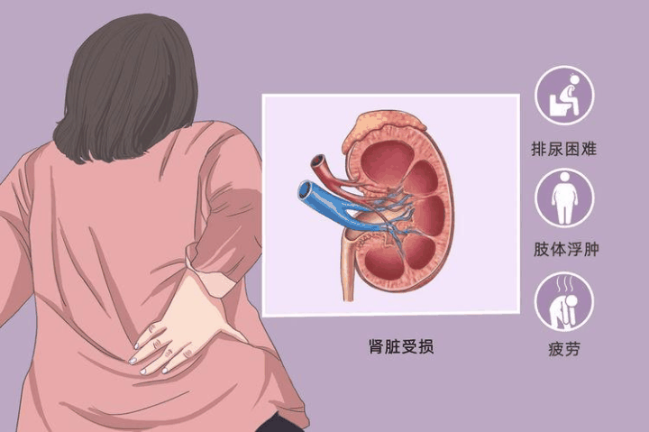 【全民营养周】成人慢性肾脏病食养指南