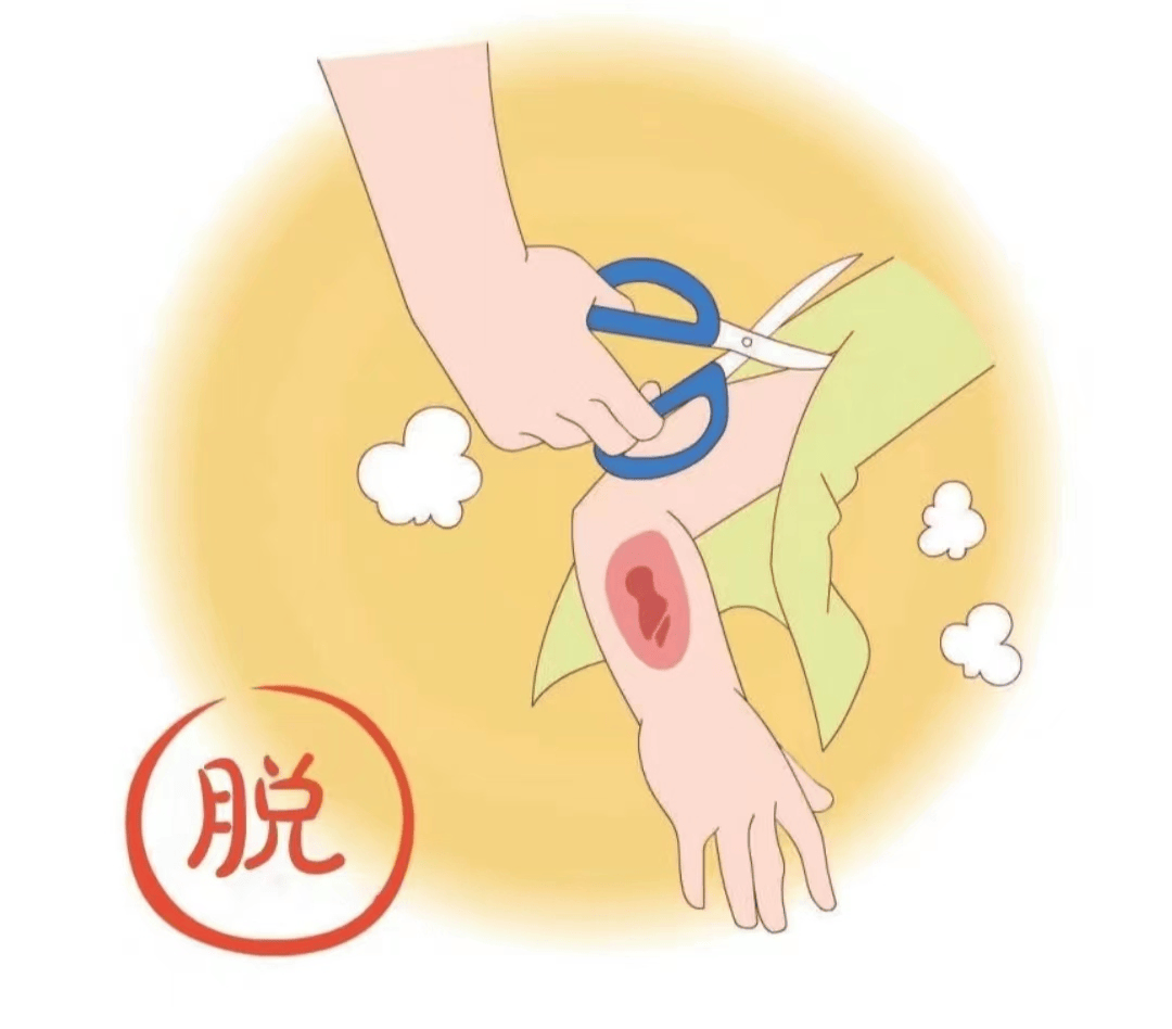 【健康科普】烧烫伤的正确处理方式来了