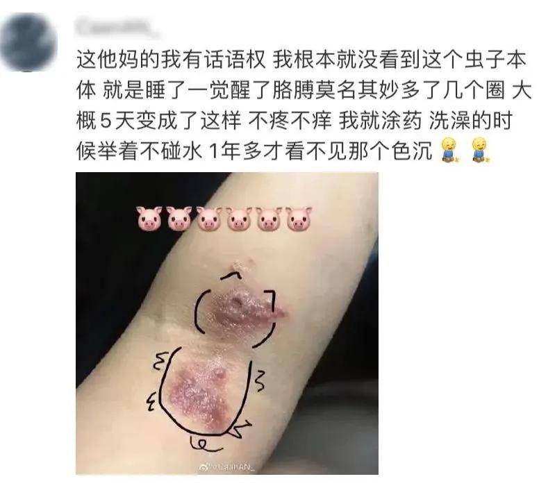 这种虫千万不能拍!毒液堪比硫酸