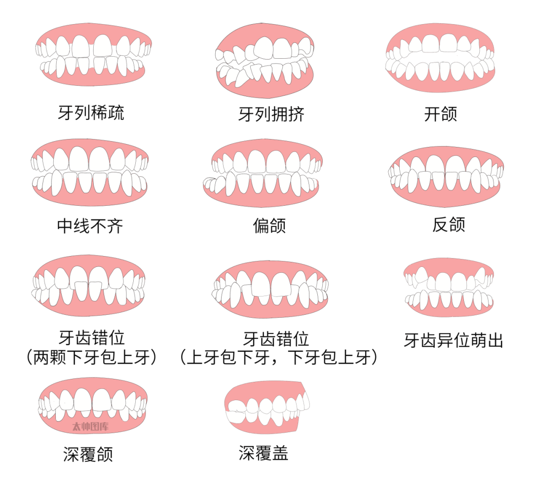 牙齿的种类有哪些图片