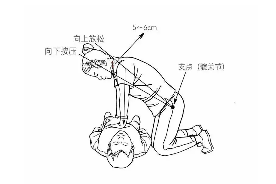 心肺复苏手势左右手图片