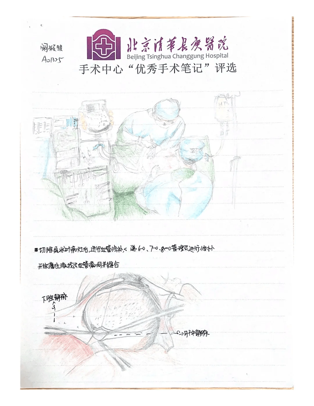 分享一份让护理部都为之颤抖的手术护理笔记