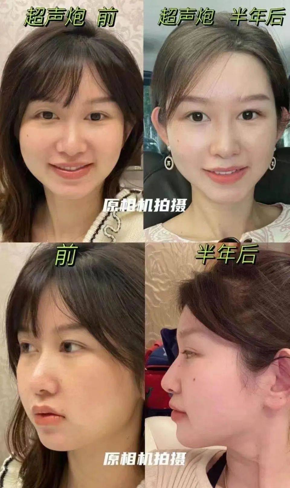 960_1618竖版 竖屏