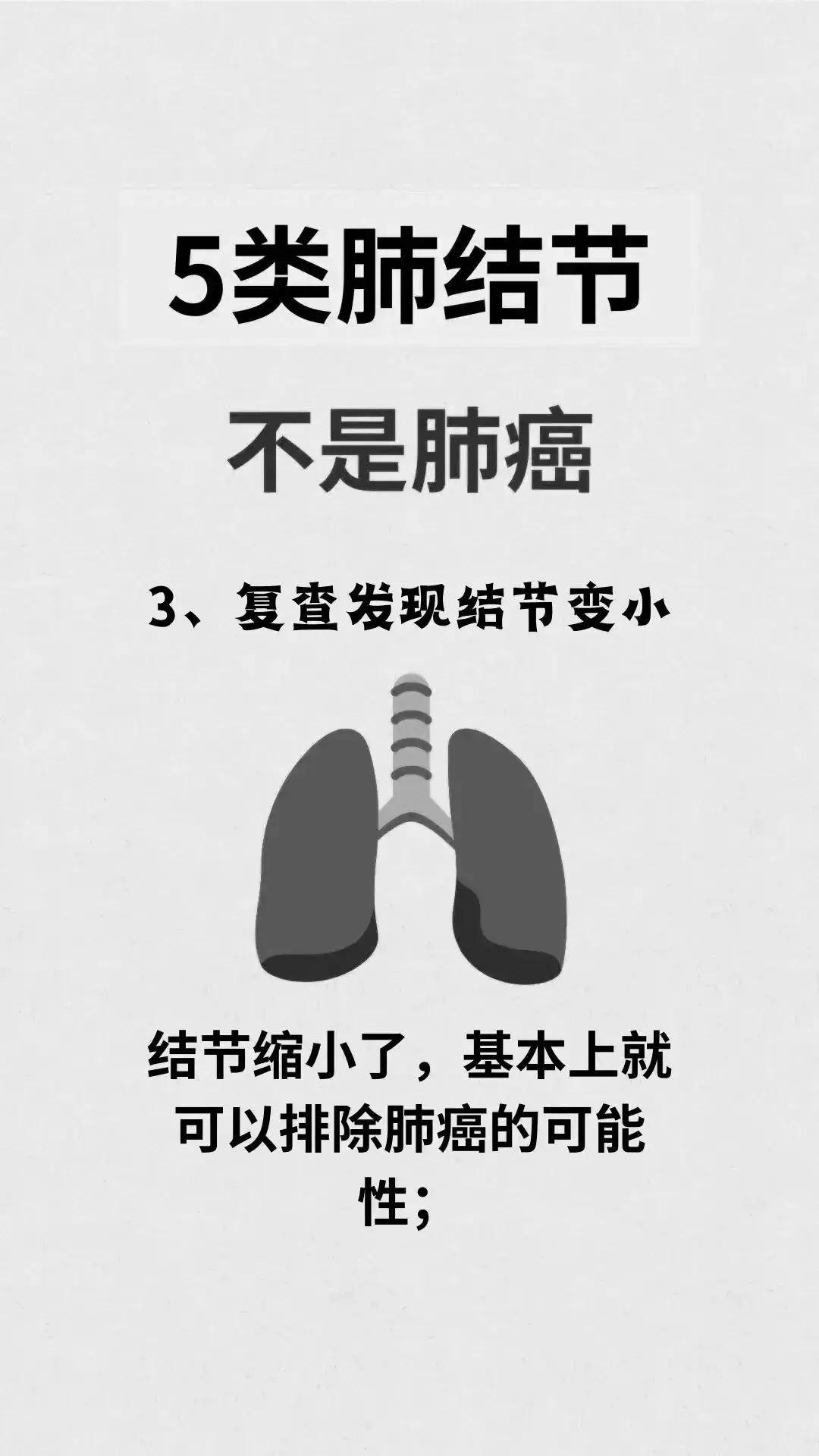 肺结节知识大揭秘:这些年,被误读的5类结节!