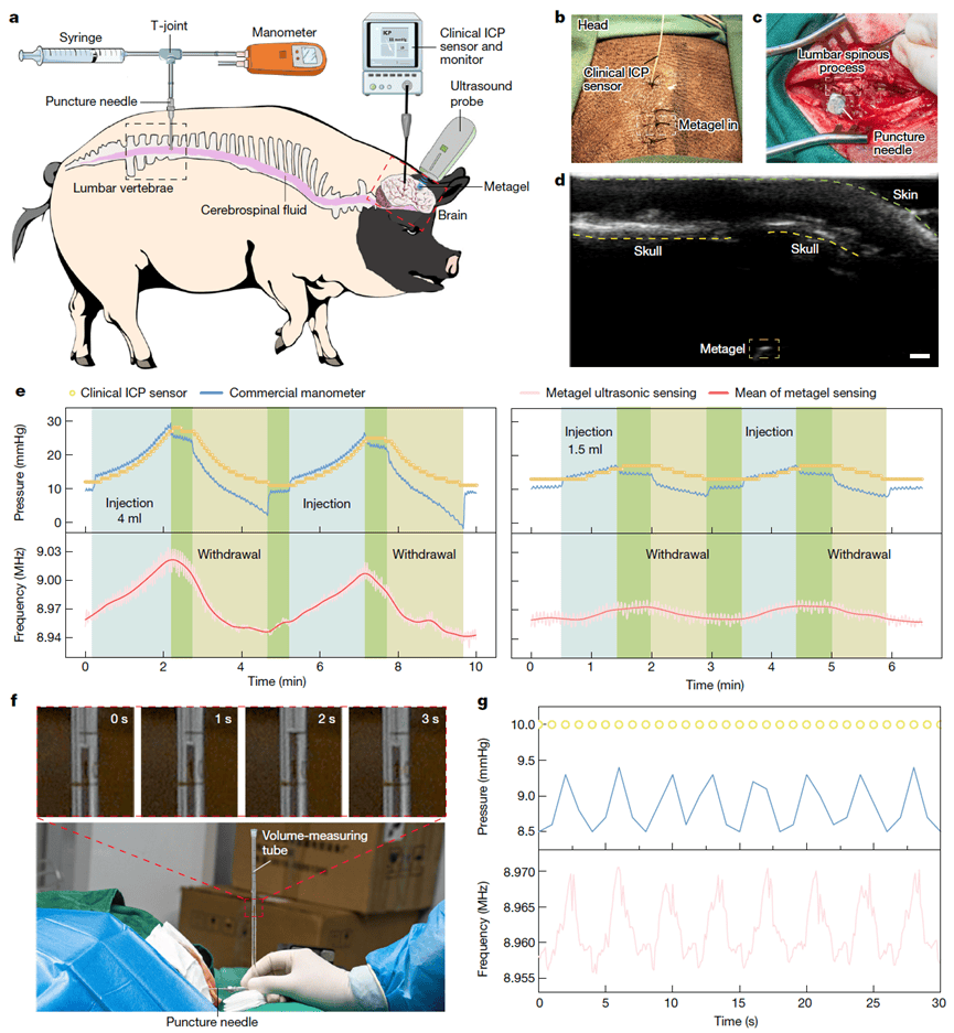 无线探测大脑的新时代来了!新型智能超材料登上今日《自然》 | 附视频