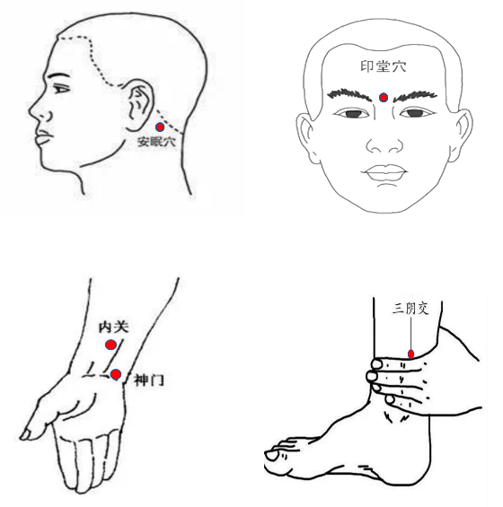 失眠针灸准确位置图图片
