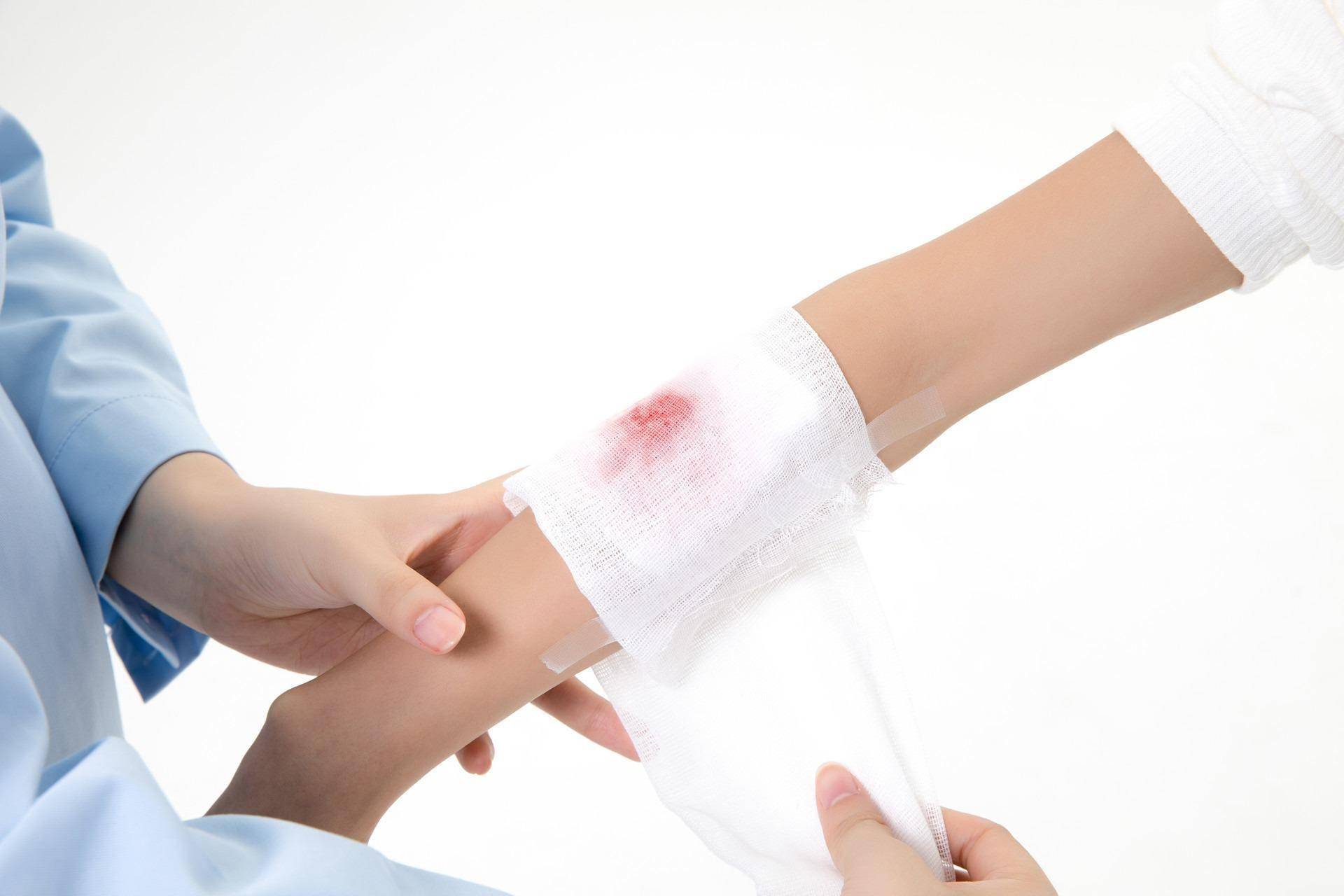 对于伤口护理,我们应该及时清洁和处理伤口,使用肥皂和清水进行清洁