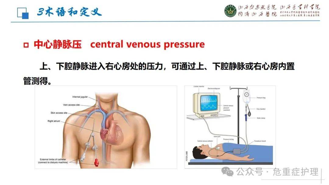 【ppt】中心静脉压测量技术（最新中华护理学会团体标准）