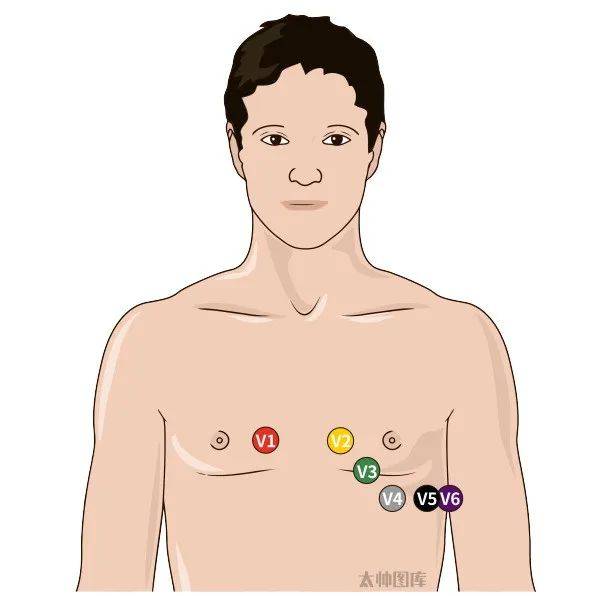 心电监护连接位置图图片