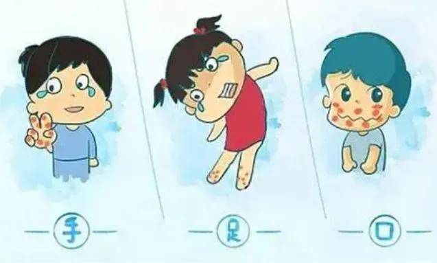 手足口病是由多种肠道病毒引起的传染性疾病,以发热和手,口腔,足部等