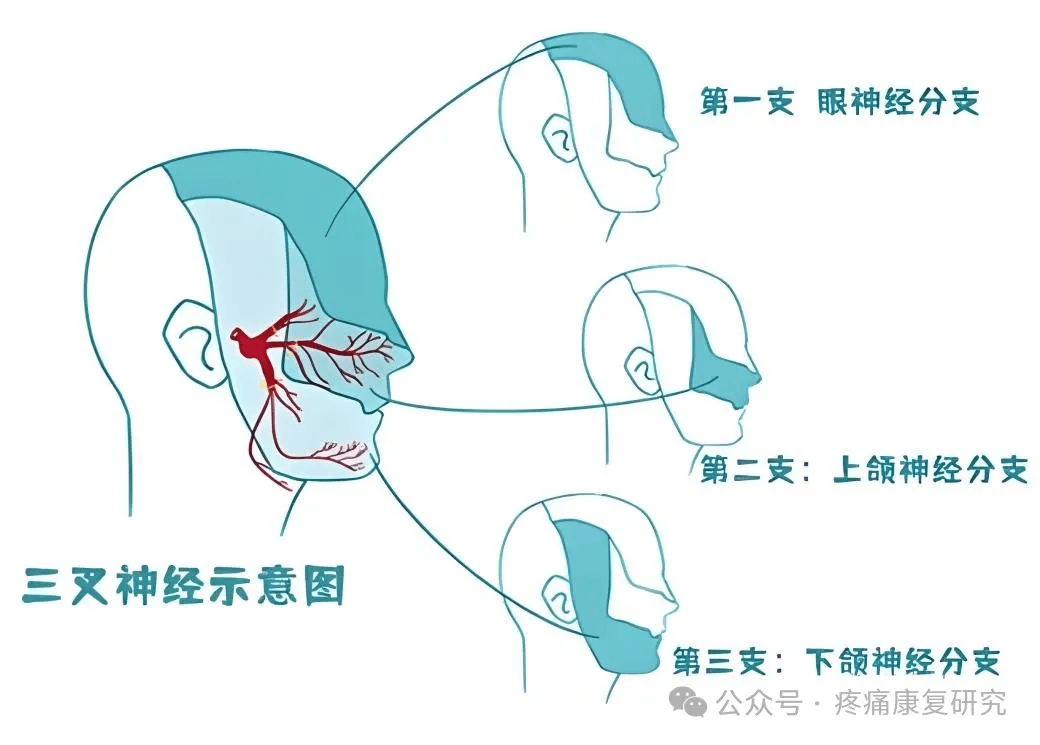 三叉神经简笔画图片