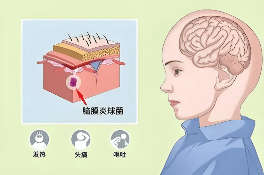 我大名叫流行性脑脊髓膜炎,小名叫流脑,是《中华人民共和国传染病防治