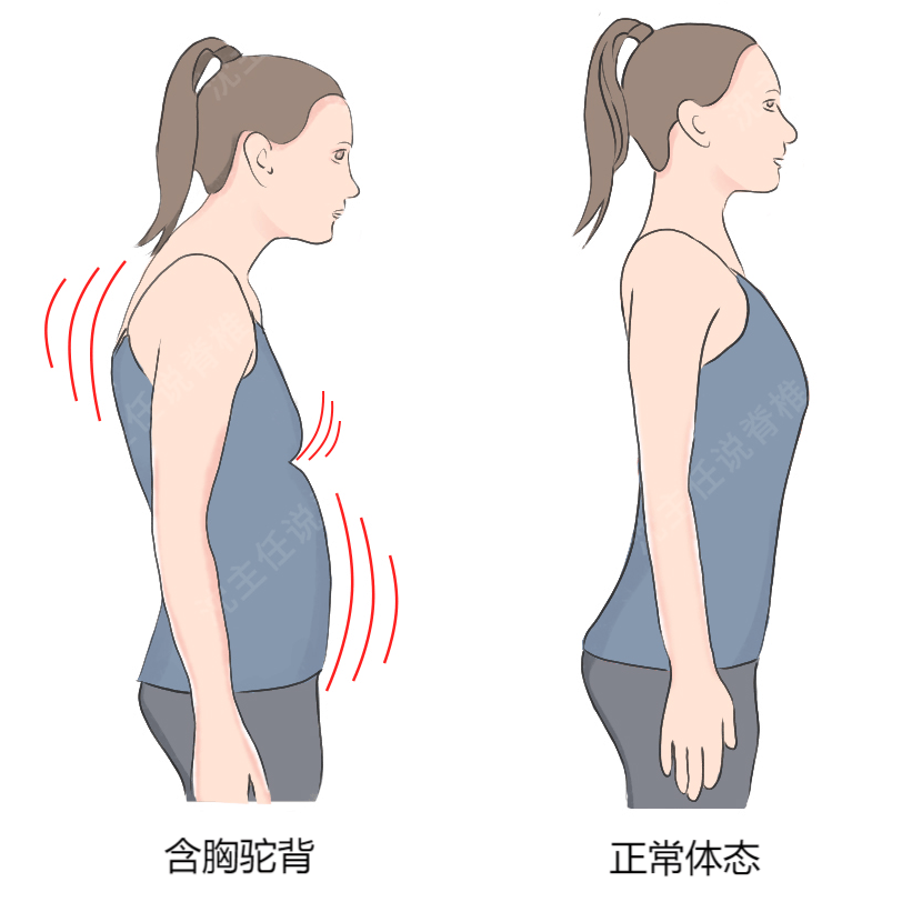 别让含胸驼背毁掉你的气质 教你3个动作