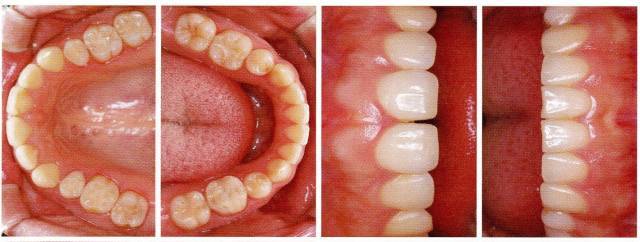 让每位医生都能拍好口腔摄影的方法!