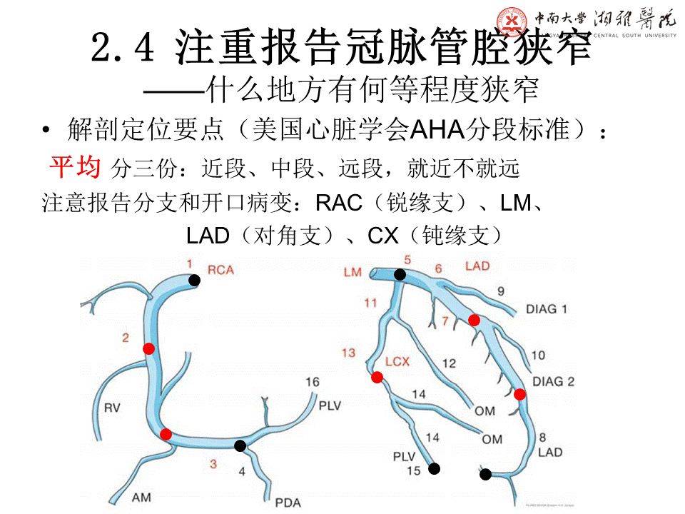 冠状动脉右优势型图片