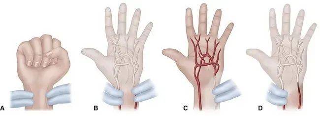 手腕上的大动脉在哪图片