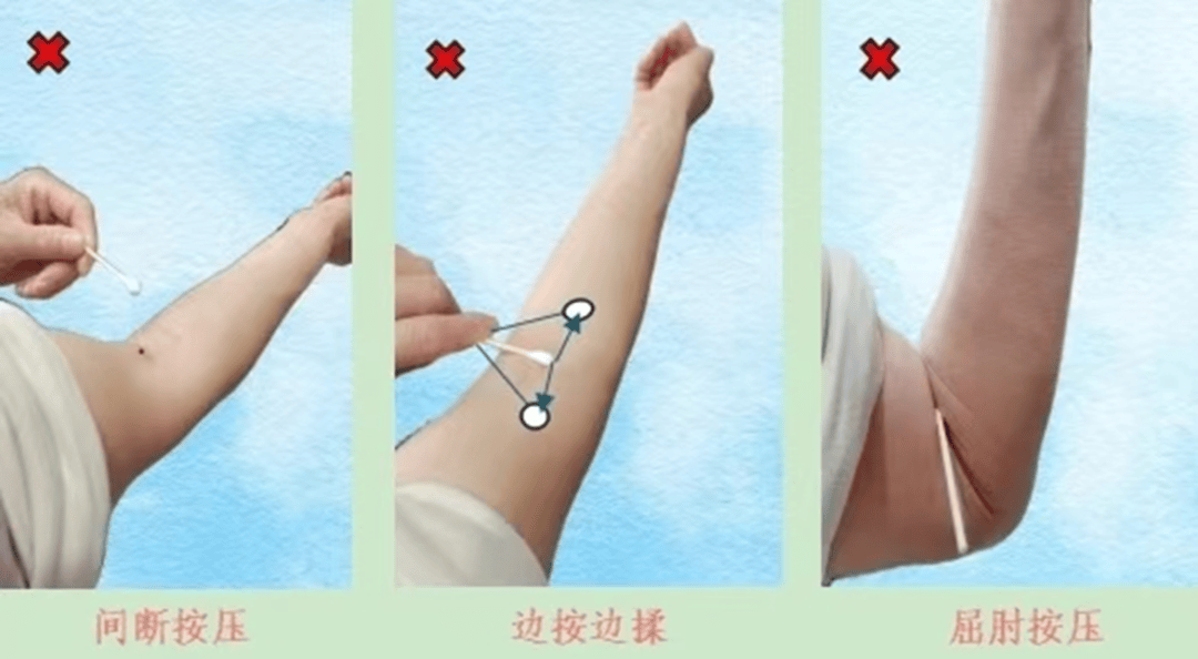 正确方法:七,采血后为什么针眼处会出现淤青,血肿?