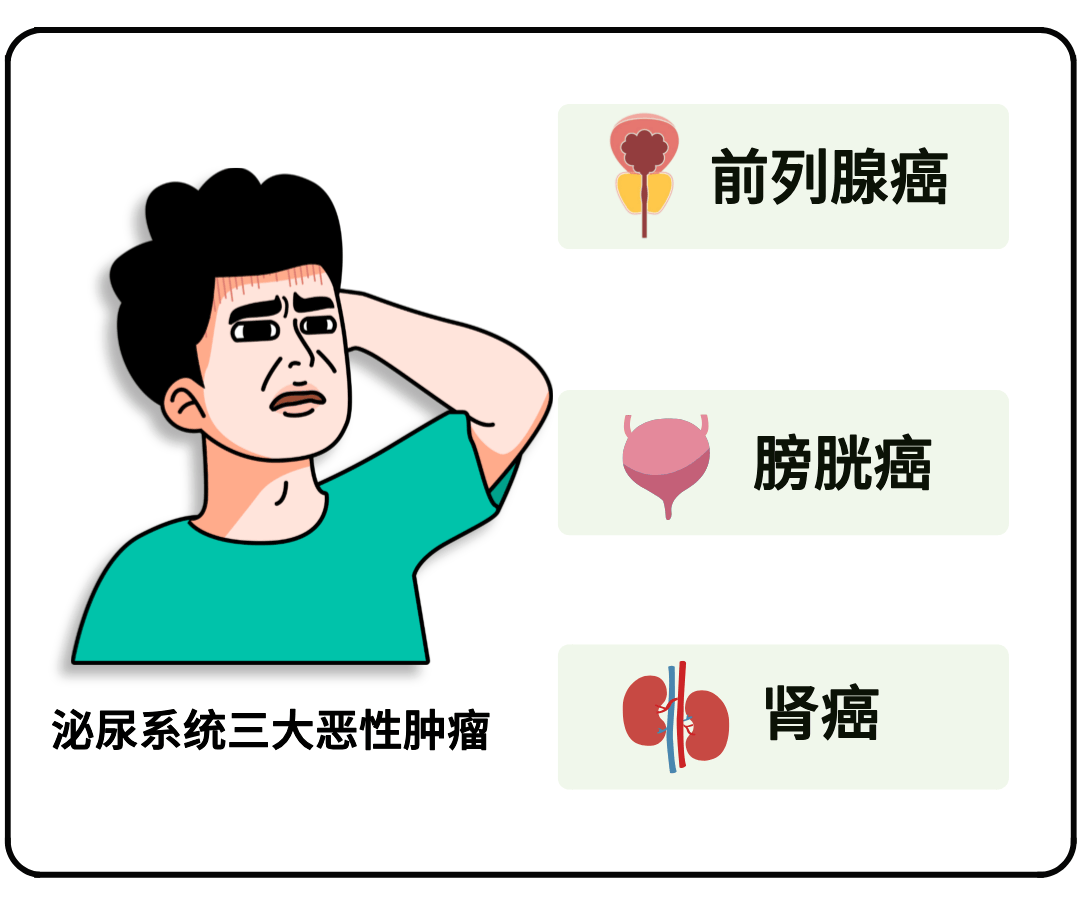 膀胱癌挂号挂什么科(膀胱癌去泌尿外科还是肿瘤科)