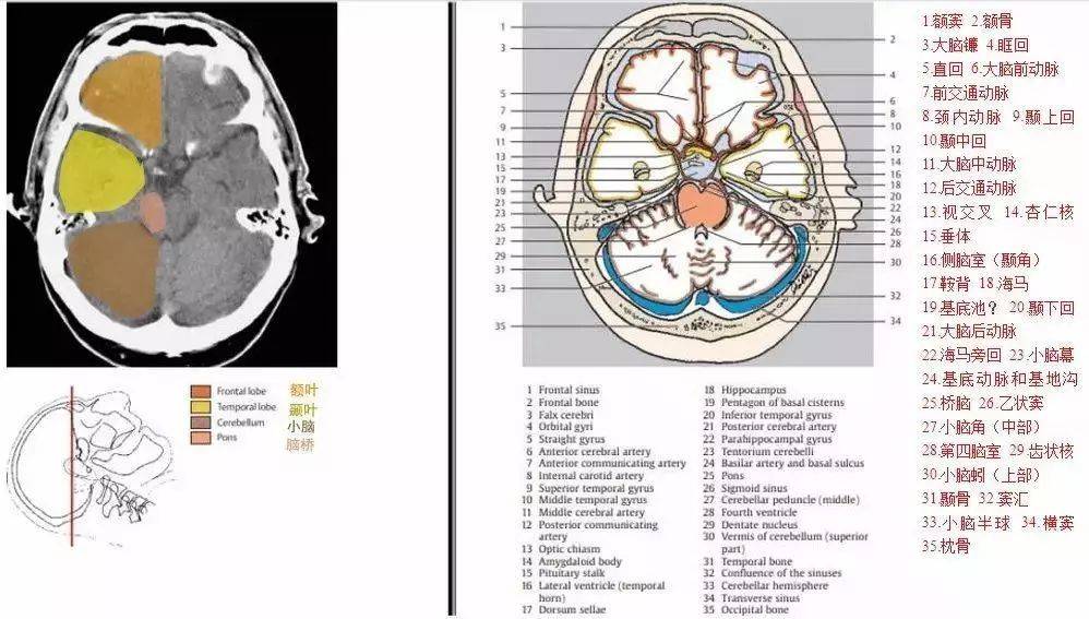 脑部ct结构图片